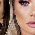 Why Lip Fillers Look Bad: A Guide to Achieving Natural Results