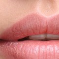 What are the Longest Lasting Lip Fillers?