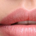 Which Lip Fillers Last the Longest?