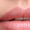 When Do Lip Fillers Settle? A Comprehensive Guide