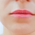 The Benefits of Lip Fillers: A Comprehensive Guide