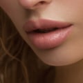 When Do Lip Fillers Stop Hurting?