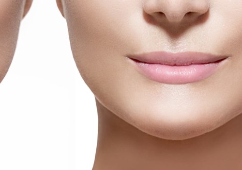 How Long Do Lip Fillers Last? Expert Advice on Lip Injections