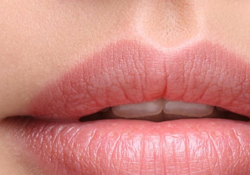 What are the Longest Lasting Lip Fillers?