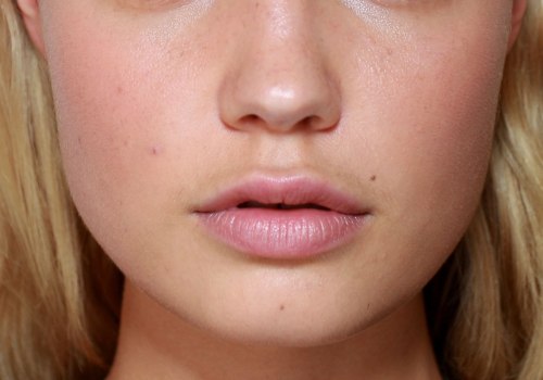 Why Lip Fillers are the Latest Beauty Trend